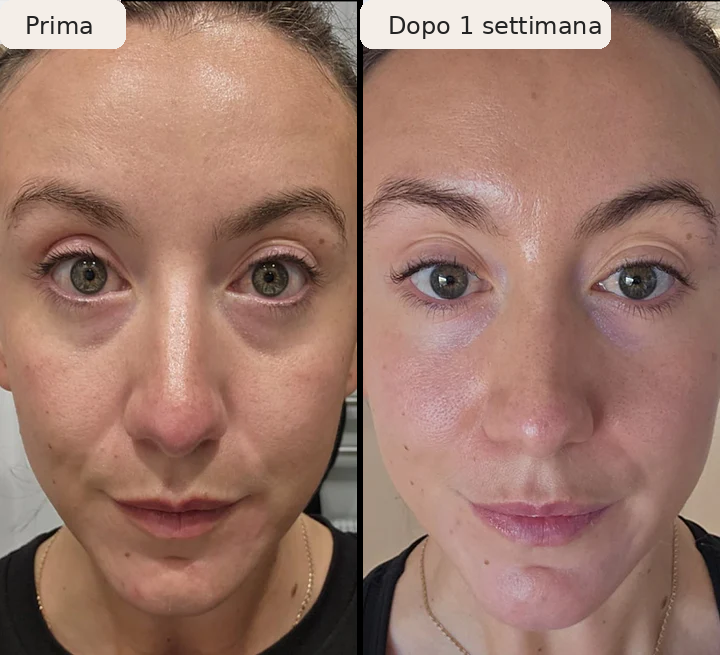 Lyvia -  Sguardo più fresco, liscio e riposato già dal primo trattamento